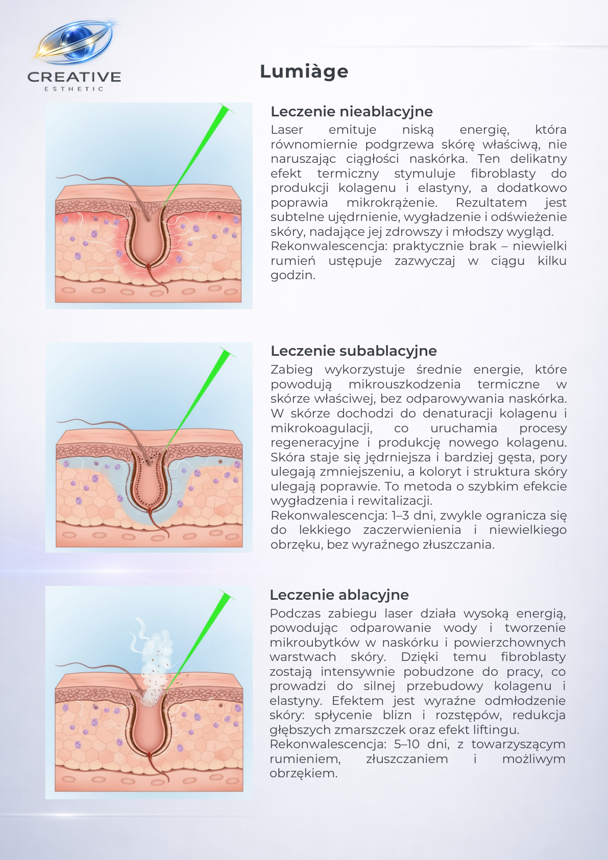 Tryby nieablacyjny, subablacyjny i ablacyjny Lumiàge